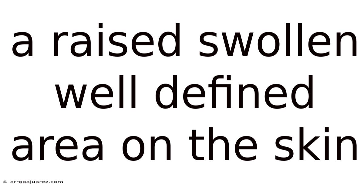 A Raised Swollen Well Defined Area On The Skin