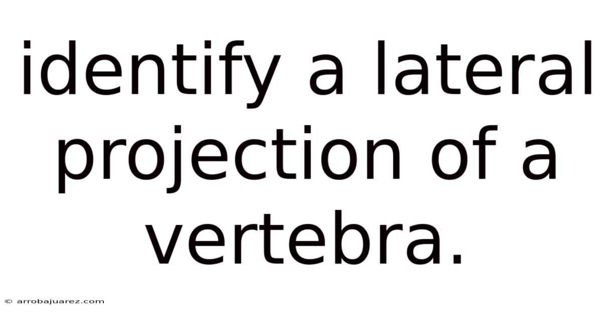 Identify A Lateral Projection Of A Vertebra.