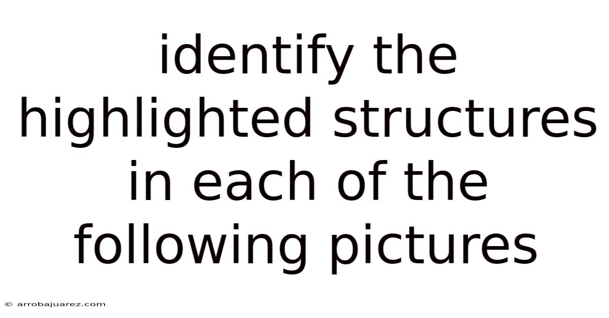 Identify The Highlighted Structures In Each Of The Following Pictures