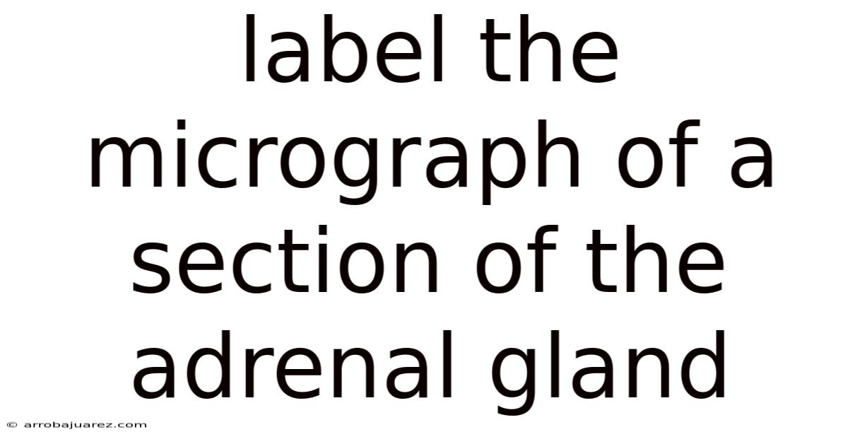 Label The Micrograph Of A Section Of The Adrenal Gland