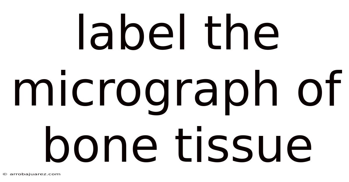 Label The Micrograph Of Bone Tissue