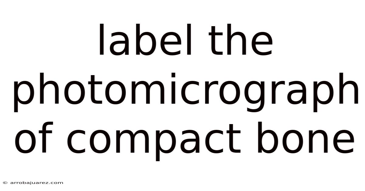 Label The Photomicrograph Of Compact Bone