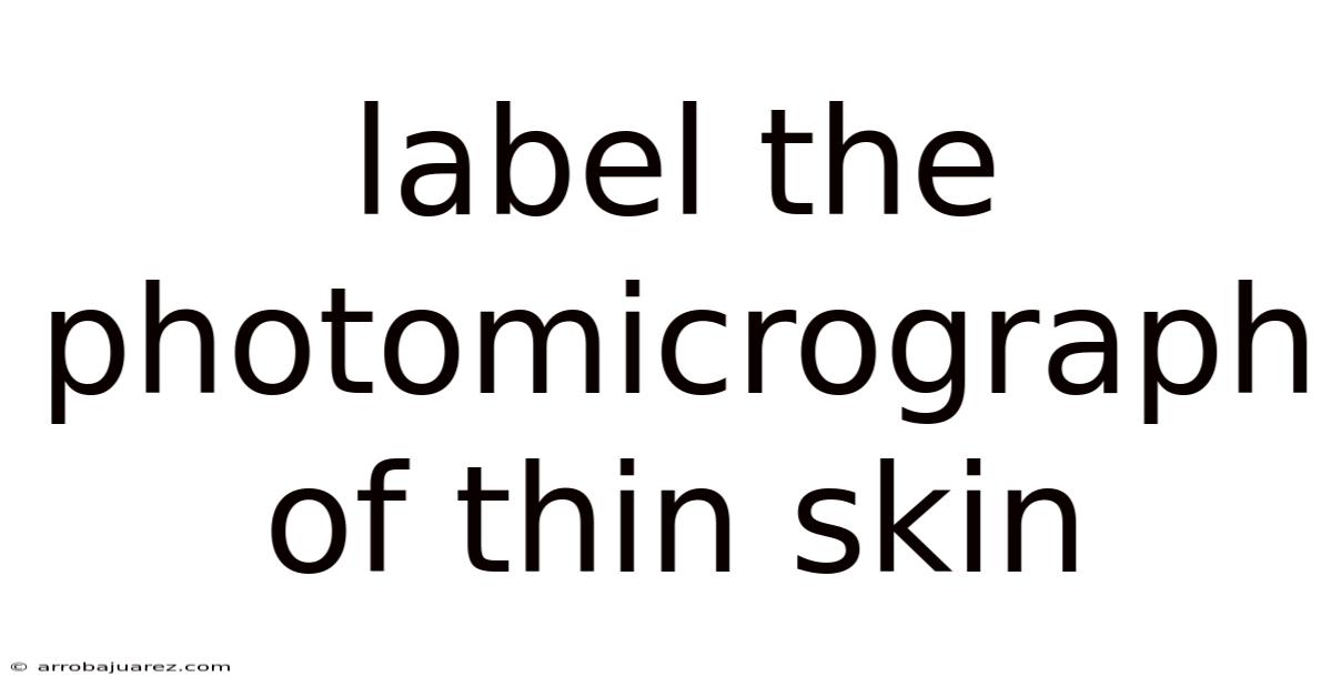 Label The Photomicrograph Of Thin Skin