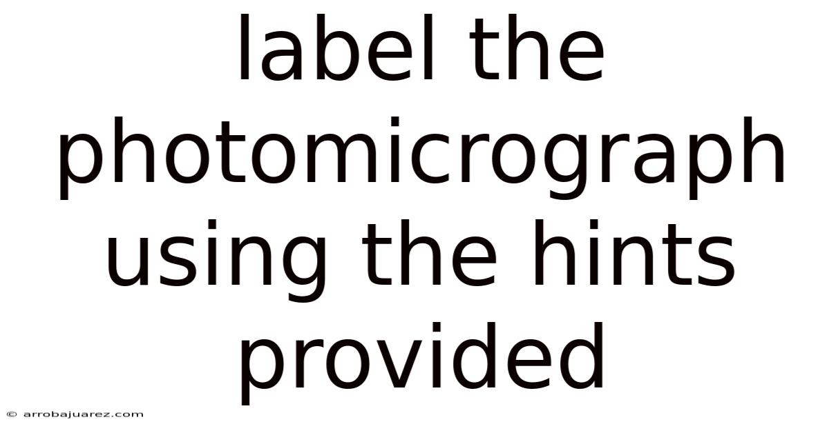 Label The Photomicrograph Using The Hints Provided
