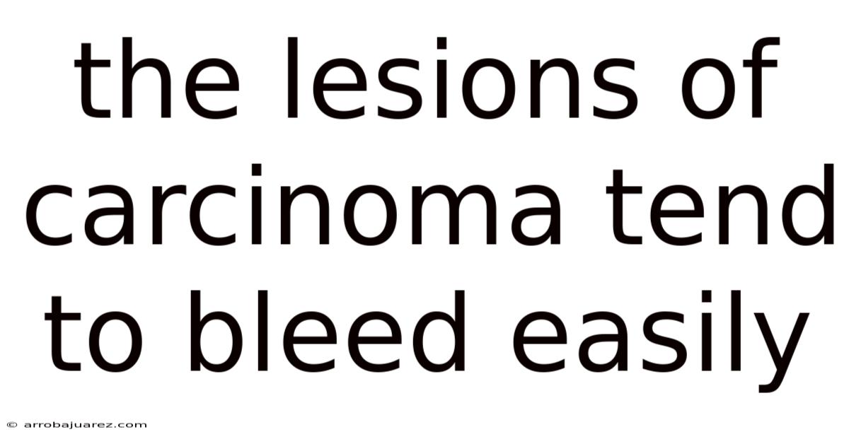 The Lesions Of Carcinoma Tend To Bleed Easily