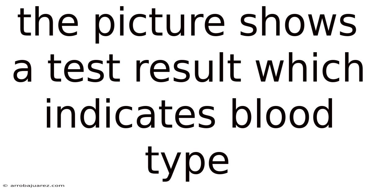 The Picture Shows A Test Result Which Indicates Blood Type