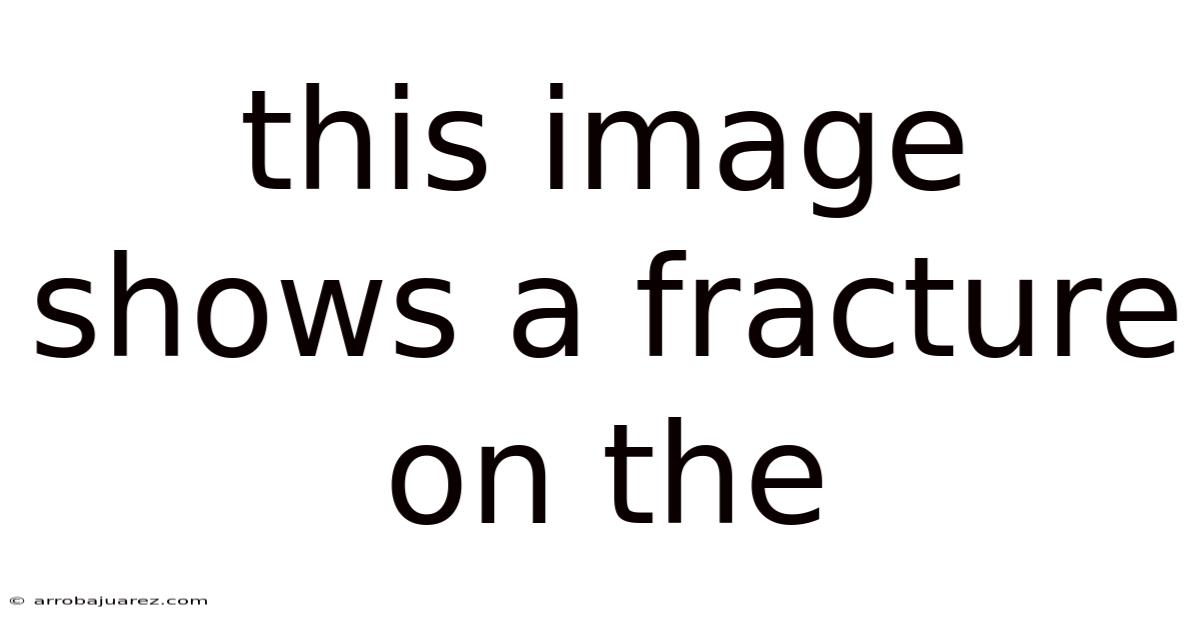 This Image Shows A Fracture On The