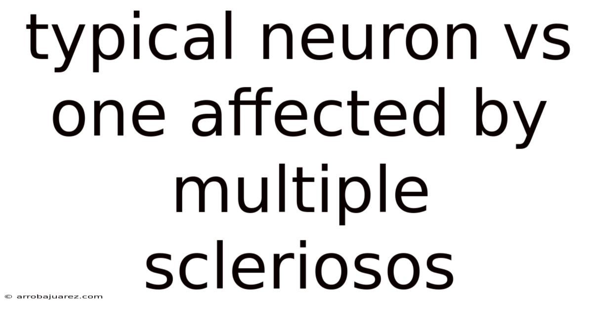 Typical Neuron Vs One Affected By Multiple Scleriosos