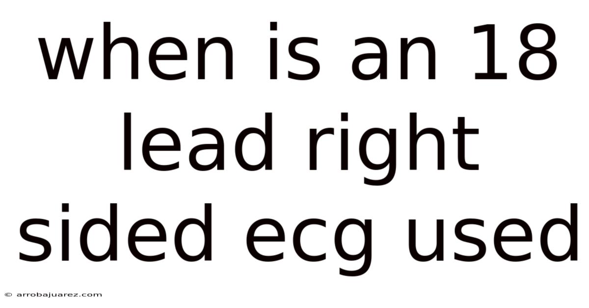 When Is An 18 Lead Right Sided Ecg Used