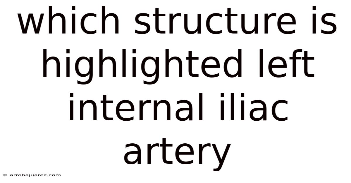Which Structure Is Highlighted Left Internal Iliac Artery